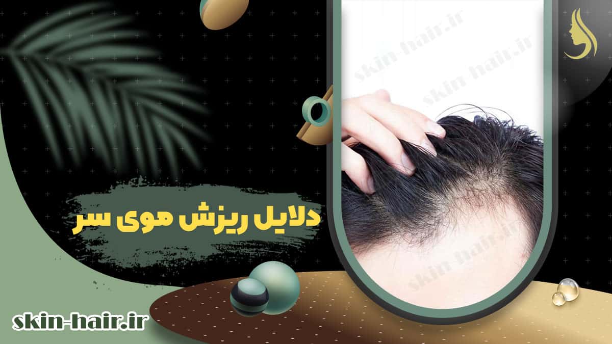 Cause of the hair loss
