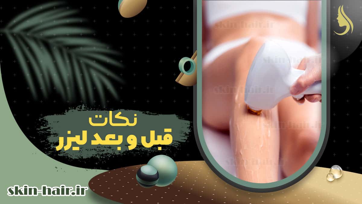 Laser before and after tips