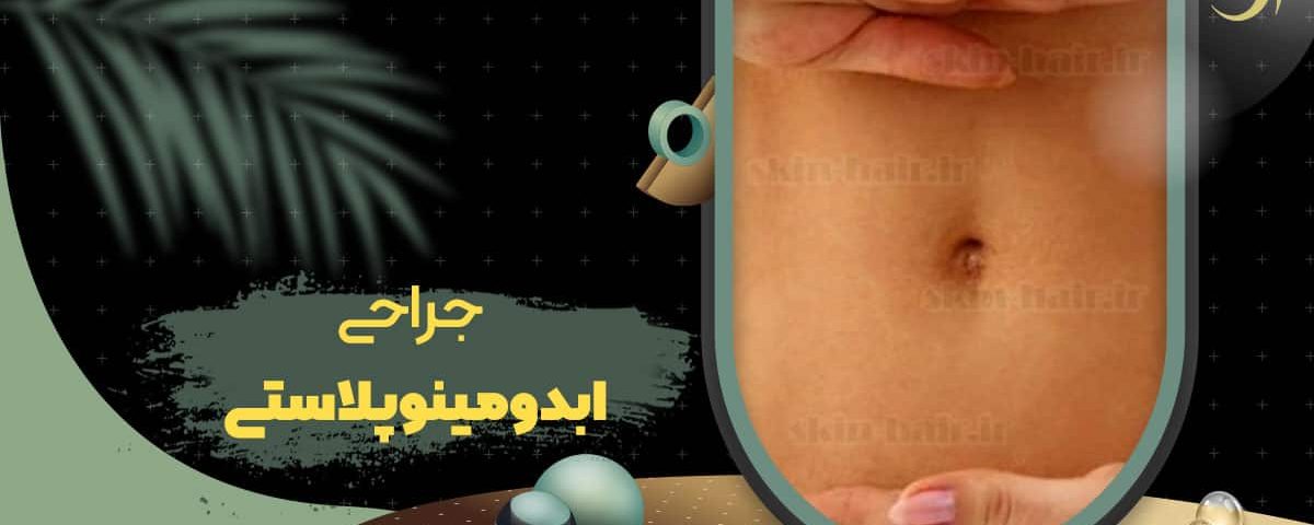 Abdominoplasty surgery