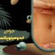 Abdominoplasty surgery