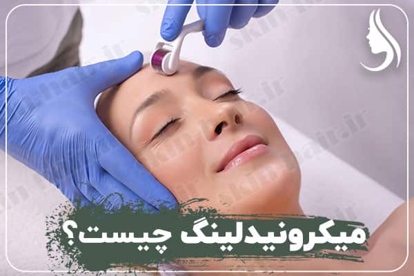 What is microneedling