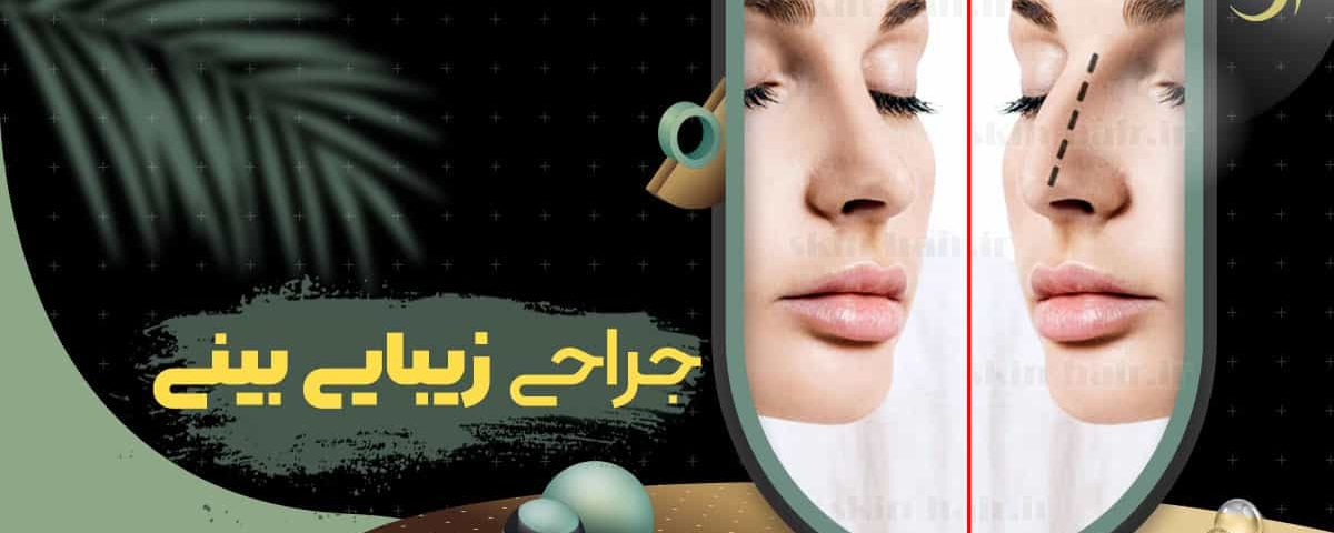 nose plastic surgery