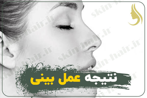 نتیجه-عمل-بینی