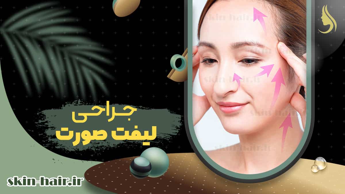 Facelift surgery