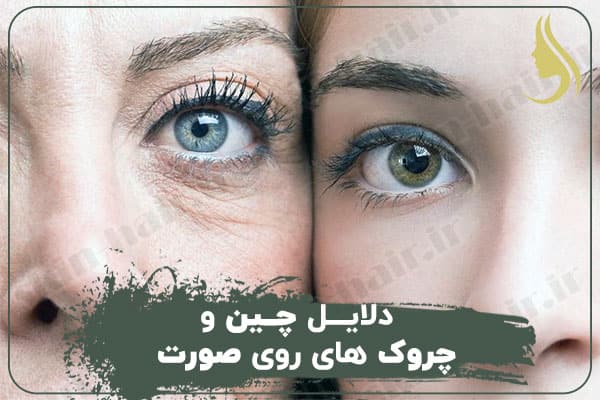 دلایل چین و چروک های صورت