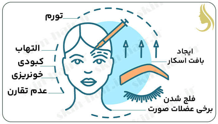 خطرات و عوارض لیفت ابرو