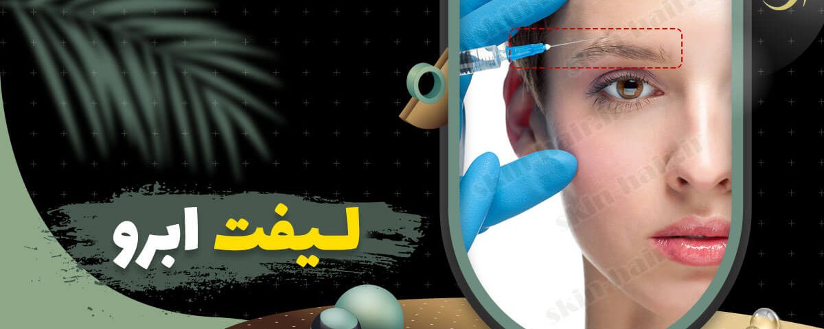 لیفت ابرو