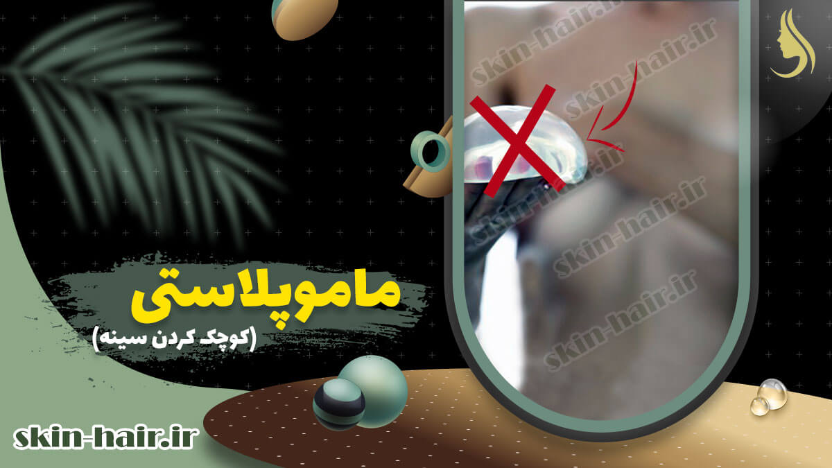 ماموپلاستی