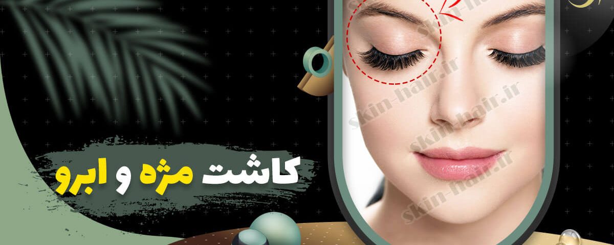 کاشت مژه و ابرو