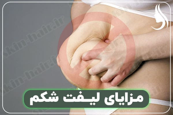 Benefits of Abdominal Lift