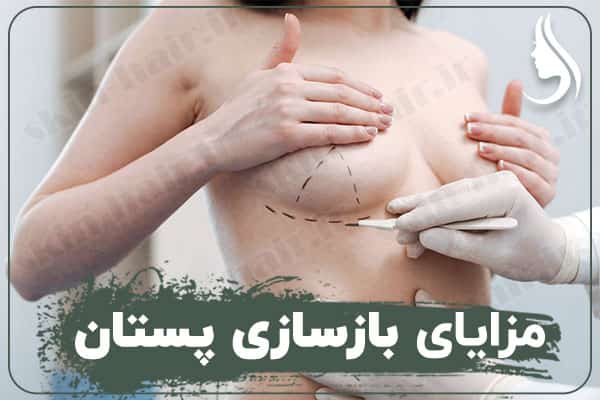 Benefits of breast reconstruction