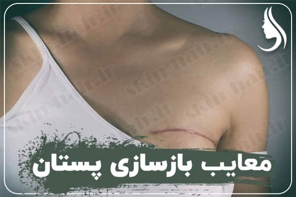 Disadvantages of breast reconstruction