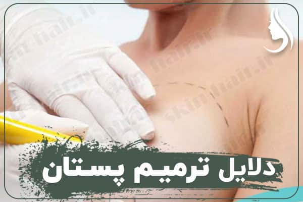 Reasons for breast repair