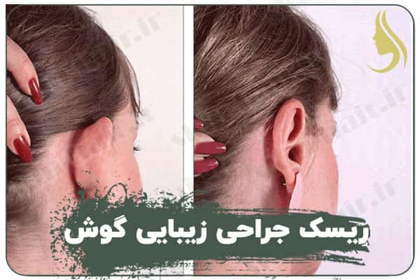 Risk of cosmetic ear surgery